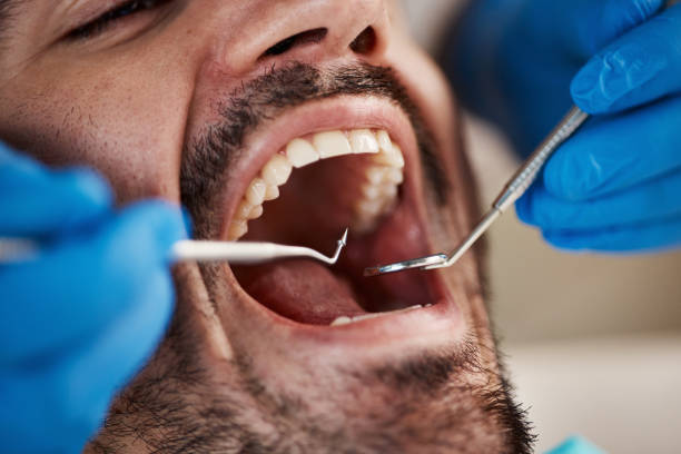 Best Orthodontic Emergency Dentist in Kinder, LA